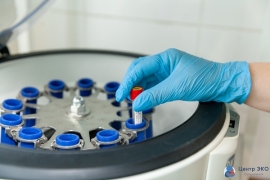 ЭКО с донорским генетическим материалом – банки спермы и ооцитов